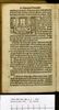 1561.NT.dut.HA.a 1 P4v